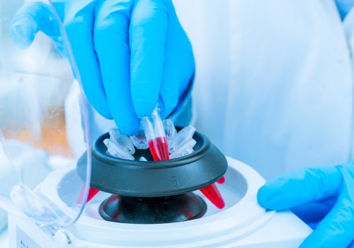 Centrifuge for DNA extraction