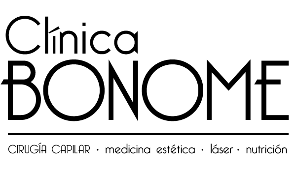 Implante Capilar Tenerife